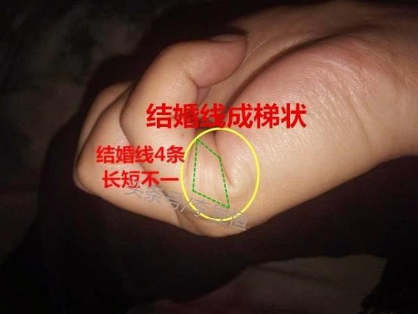 夫妻必离婚的手相有哪些特征?婚姻线末端下垂